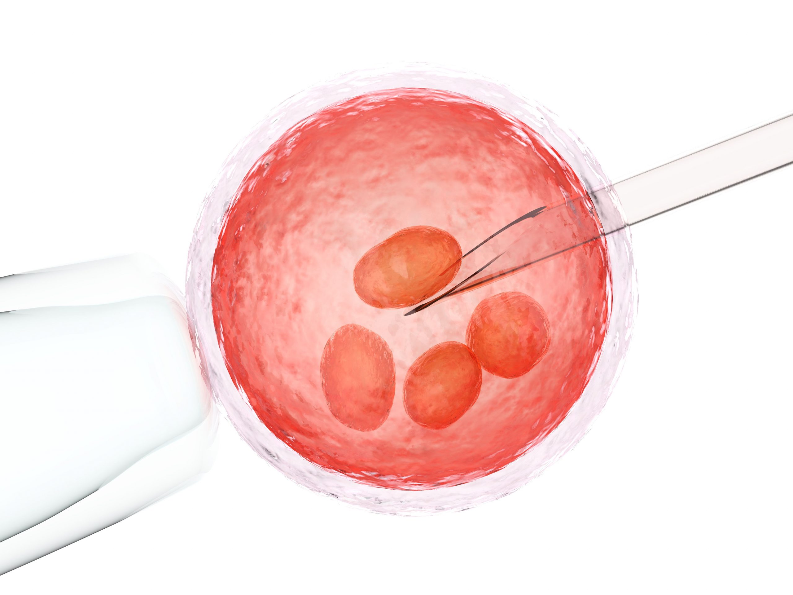 Pobranie komórki jajowej do in vitro krok po kroku